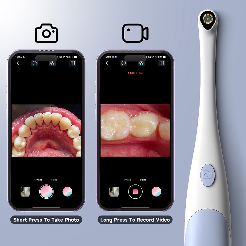 Oral Endoskop Kamera 1440P Fot - Photography Lighting Diagram incelemesi ve fiyatı